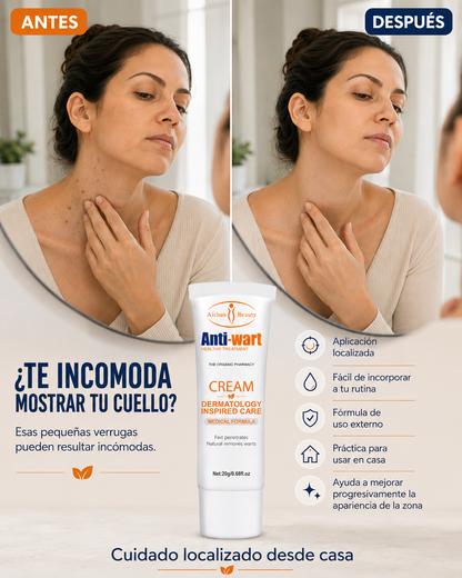 Anti Wart— Crema para Verrugas, tratadas desde casa